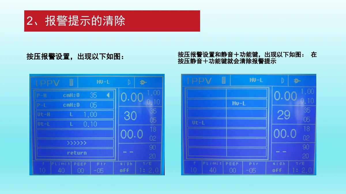 麻醉机安装与操作资料第42页