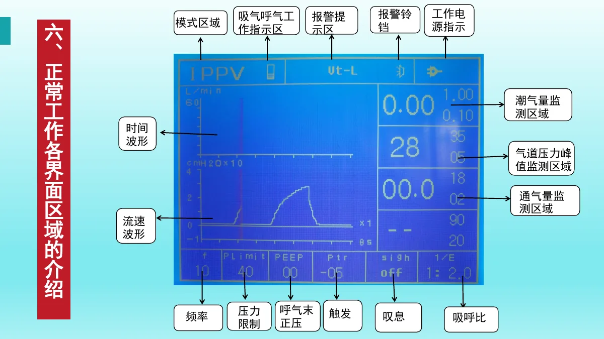 麻醉机安装与操作资料第43页