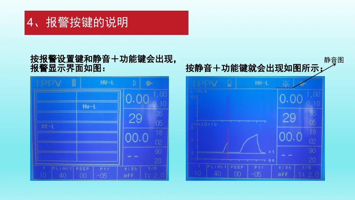 麻醉机安装与操作资料第52页