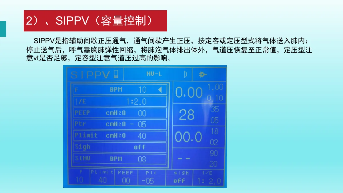 麻醉机安装与操作资料第57页